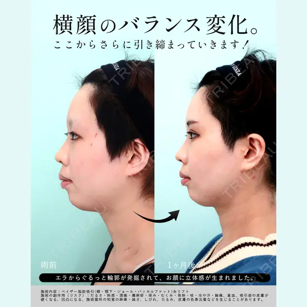 WOM CLINIC GINZA （ワム クリニック ギンザ） 淺川 雅道医師の症例