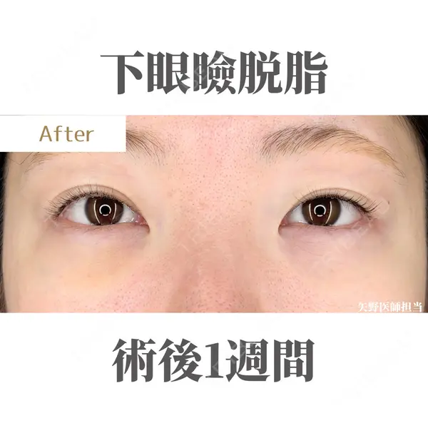 Belle Via Clinic 矢野翼医師の症例