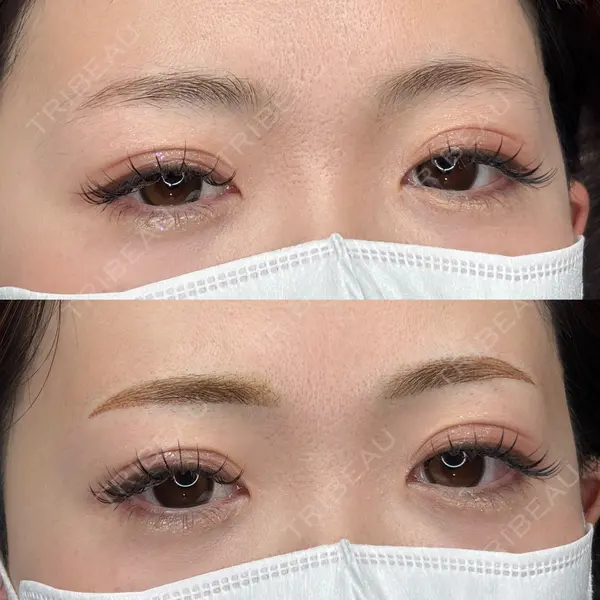 MEMOTO CLINIC 名古屋 宮崎久留明医師の症例