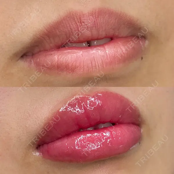 MEMOTO CLINIC 名古屋 宮崎久留明医師の症例