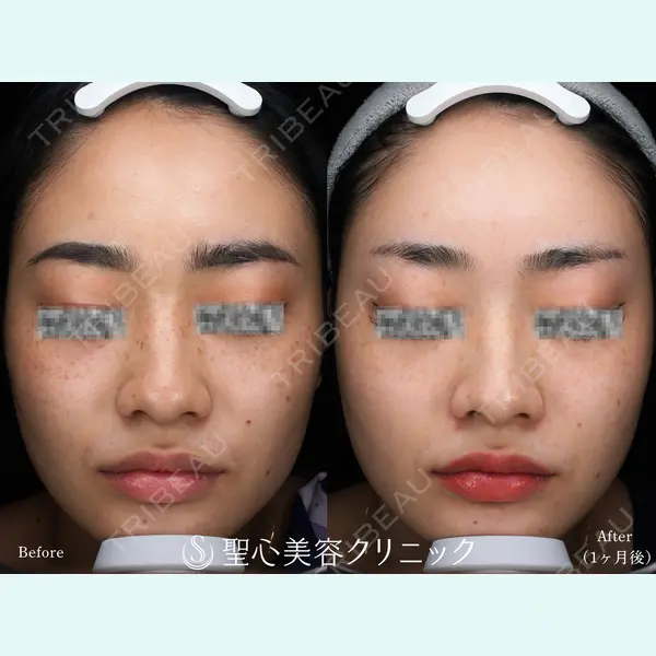 聖心美容クリニック 広島院の症例