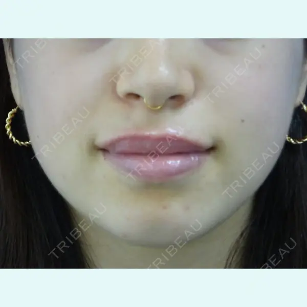 表参道スキンクリニック 名古屋院（DAILY SKIN CLINIC提携院） 河村 拓海医師の症例