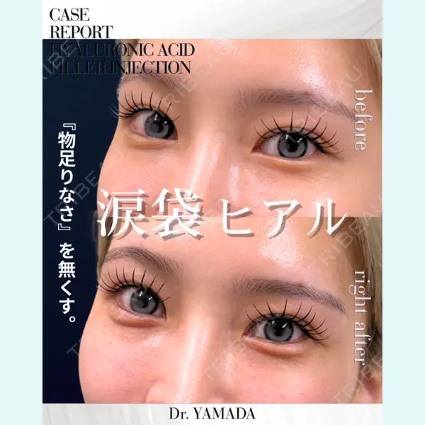 春山記念病院 山田 浩之医師の症例