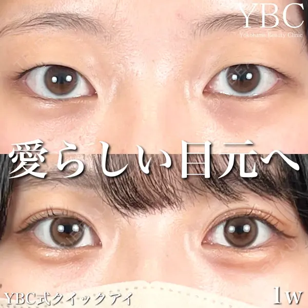 YBC横浜美容外科 池袋院 磯村 亮輔医師の症例