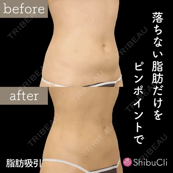 渋谷美容外科クリニック 新宿院の症例