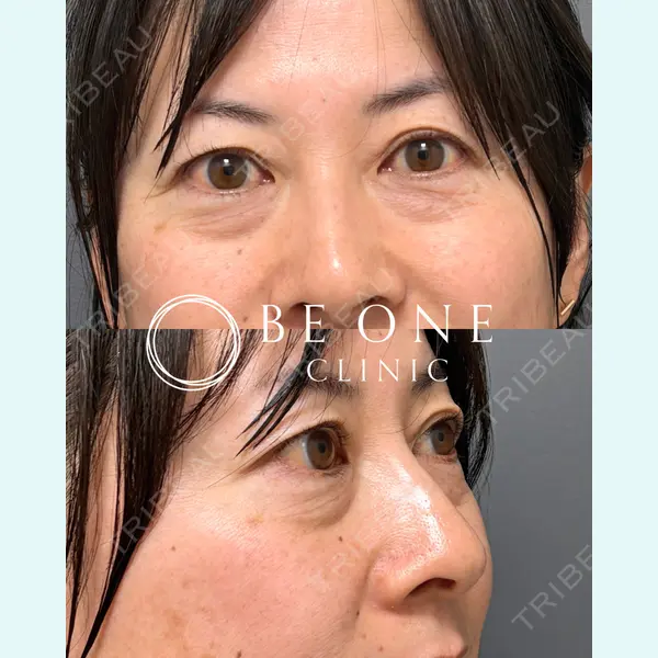 BE ONE CLINIC 小島　永稔医師の症例