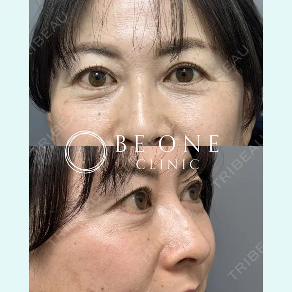 BE ONE CLINIC 小島　永稔医師の症例