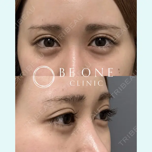 BE ONE CLINIC 小島　永稔医師の症例
