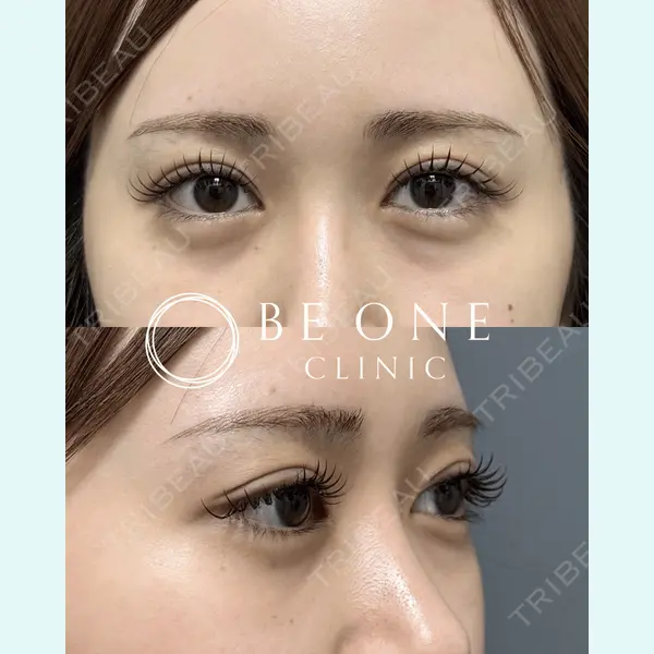 BE ONE CLINIC 小島　永稔医師の症例