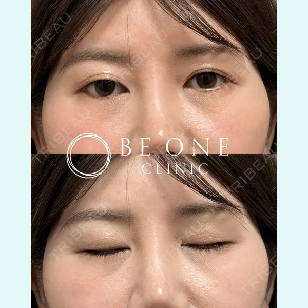 BE ONE CLINIC 小島　永稔医師の症例