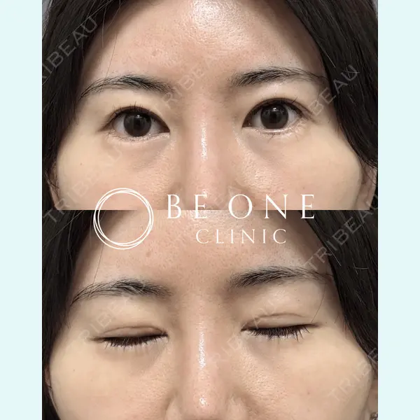 BE ONE CLINIC 小島　永稔医師の症例