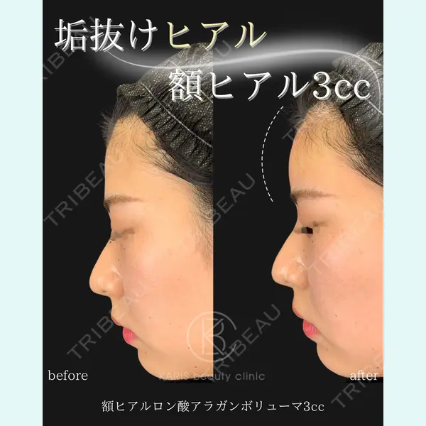 KARIS beauty clinic 滝内 ヒロフミ医師の症例
