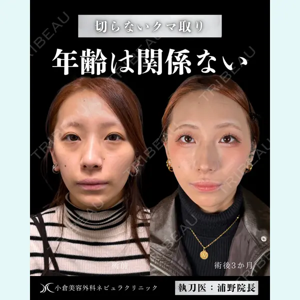 小倉美容外科ネビュラクリニック 浦野 正樹医師の症例