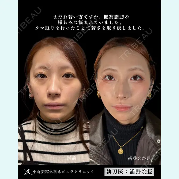 小倉美容外科ネビュラクリニック 浦野 正樹医師の症例