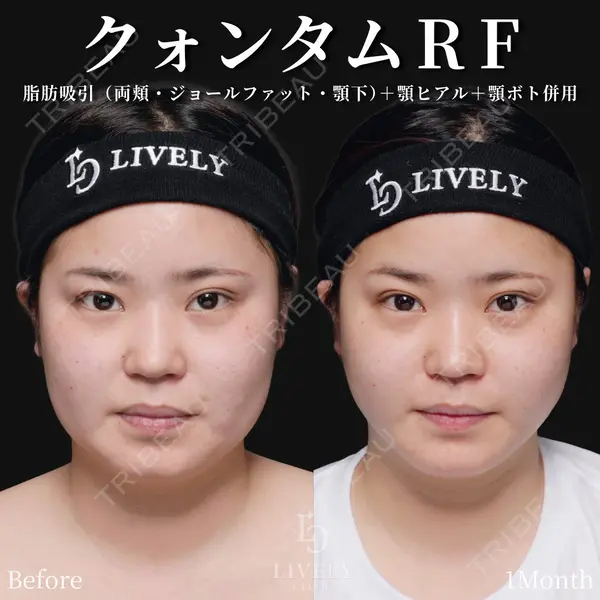 ライブリークリニック 大阪院の症例