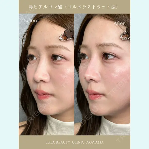 ルラ美容クリニック 岡山院 橋本 晃典医師の症例