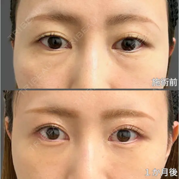 LA CLEF CLINIC（ラクレクリニック） 佐々木 健一郎医師の症例
