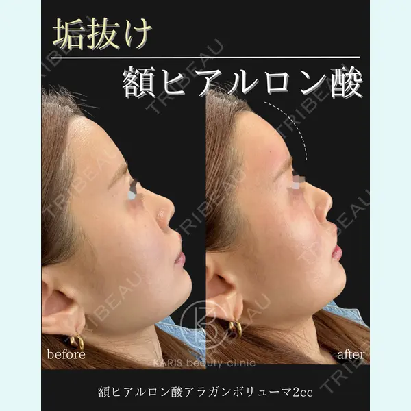 KARIS beauty clinic 滝内 ヒロフミ医師の症例