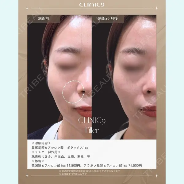 Clinic9の症例