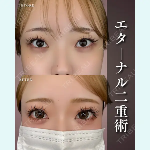 ルラ美容クリニック 池袋院 下川 洋輝医師の症例