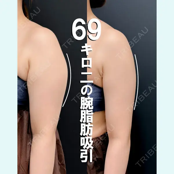 湘南美容クリニック 渋谷院 小草 智之医師の症例