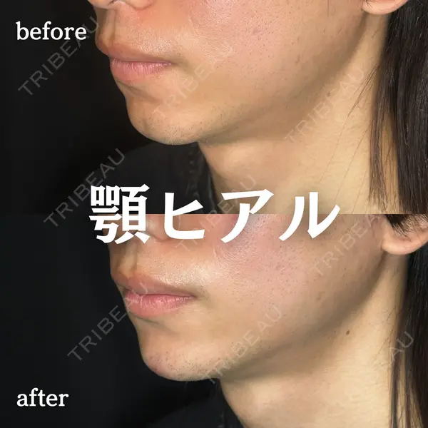 ルラ美容クリニック 新宿院 陶 美梨医師の症例