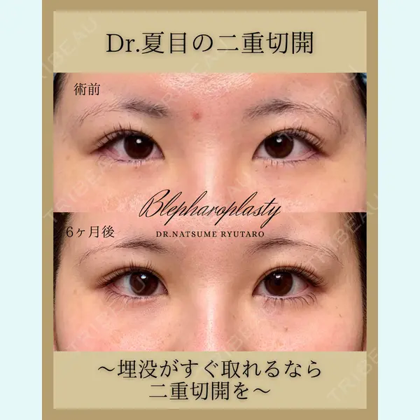 池袋麗歯科・美容皮膚科 夏目 隆太郎医師の症例