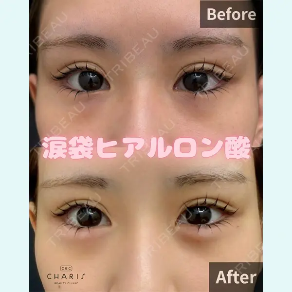 CHARIS BEAUTY CLINIC 宮内　孝維医師の症例