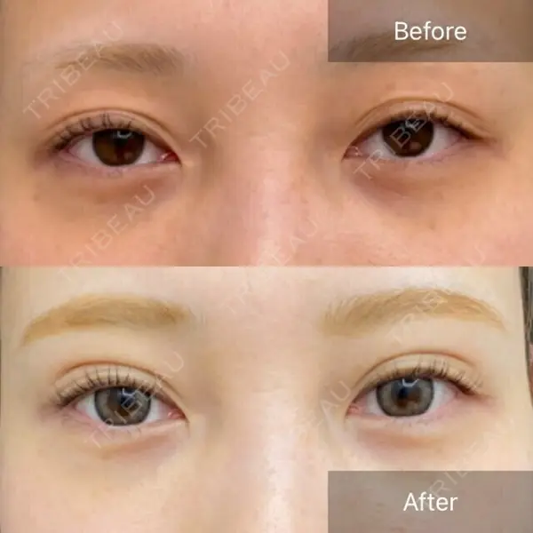 CHARIS BEAUTY CLINIC 木畑智哲医師の症例