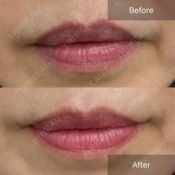 CHARIS BEAUTY CLINIC 木畑智哲医師の症例
