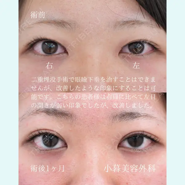 小暮整形外科・美容外科の症例