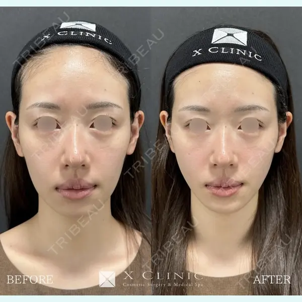 X CLINIC 恵比寿院 辻村 梢医師の症例