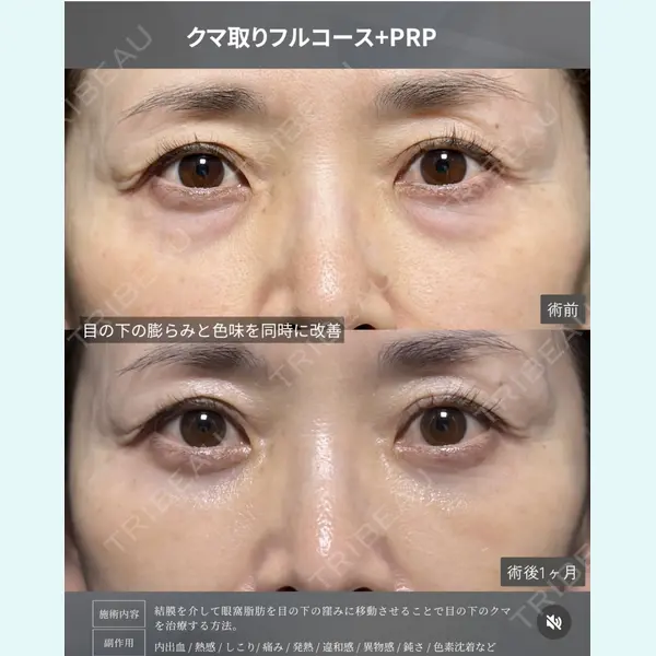 X CLINIC 銀座院 王　浚昊医師の症例