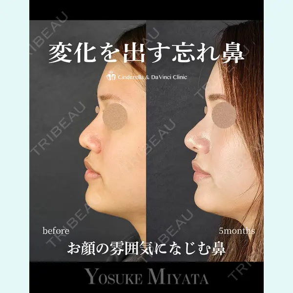 シンデレラ＆ダヴィンチクリニック 宮田 洋佑医師の症例