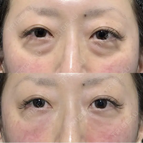 X CLINIC 銀座院 王　浚昊医師の症例