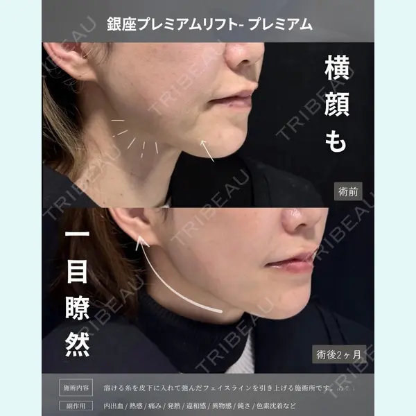 X CLINIC 銀座院 王　浚昊医師の症例