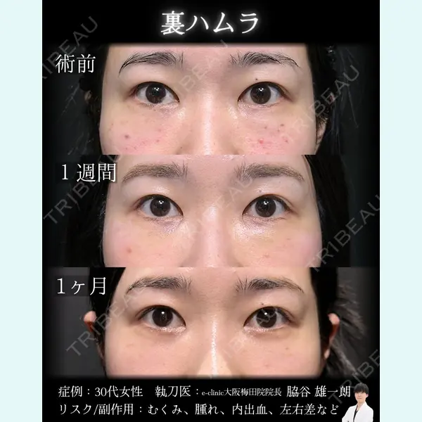 eクリニック 大阪梅田 西日本統括院 脇谷 雄一朗医師の症例