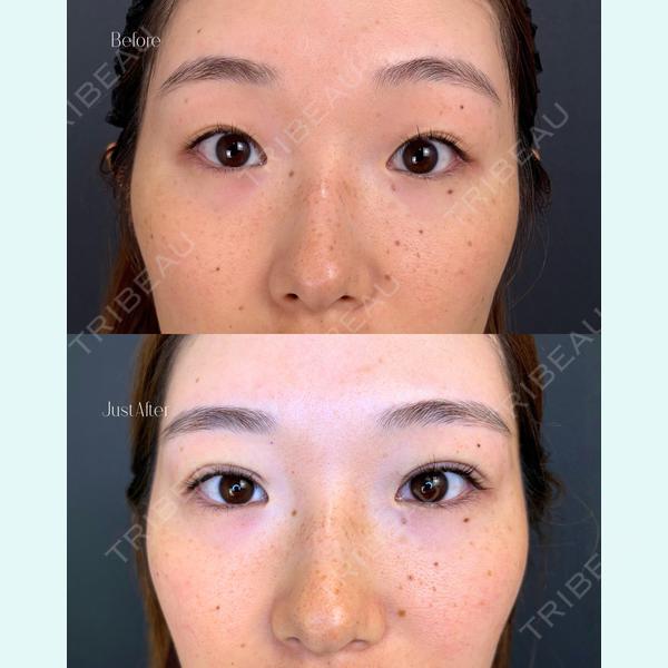 IANA CLINICの症例