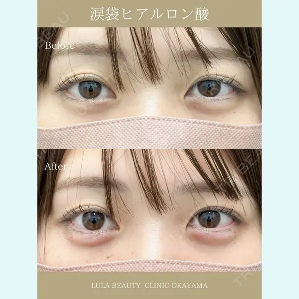 ルラ美容クリニック 岡山院 橋本 晃典医師の症例
