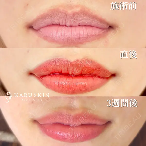 NARU SKIN Beauty Clinicの症例
