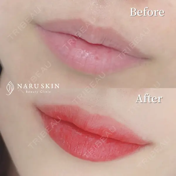 NARU SKIN Beauty Clinicの症例