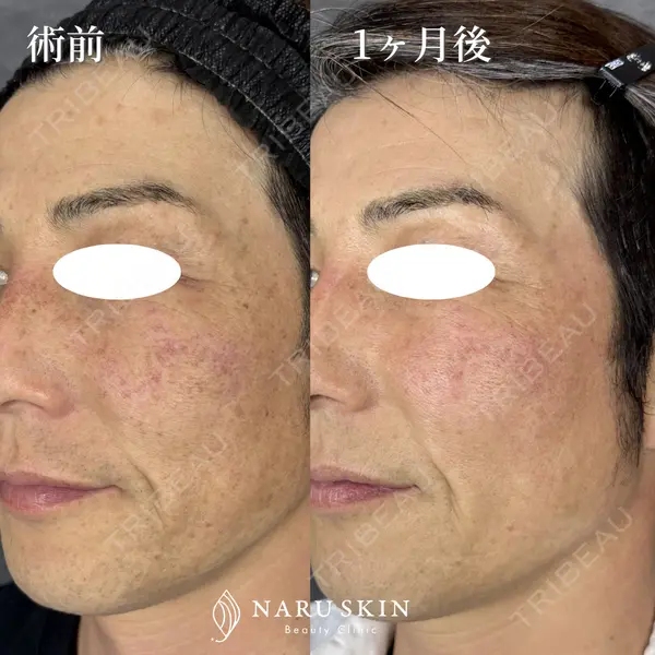 NARU SKIN Beauty Clinicの症例