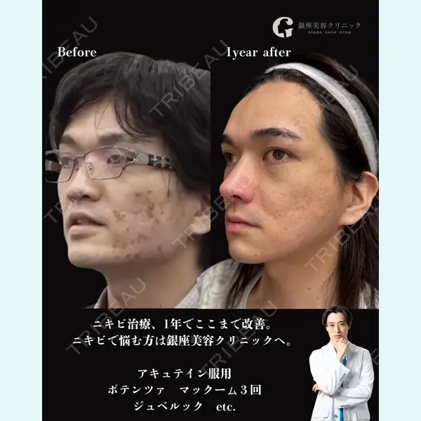 銀座美容クリニック 京都院 廣瀬 真也医師の症例