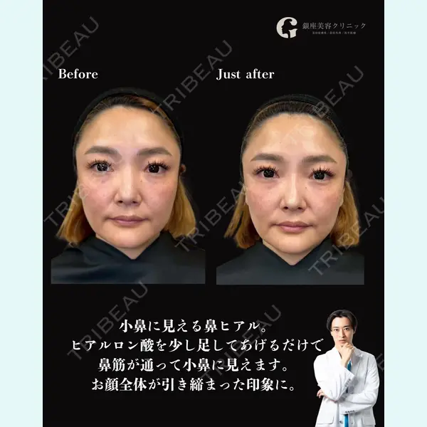 銀座美容クリニック 京都院 廣瀬 真也医師の症例