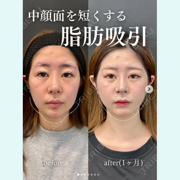 ルラ美容クリニック 上野院の症例