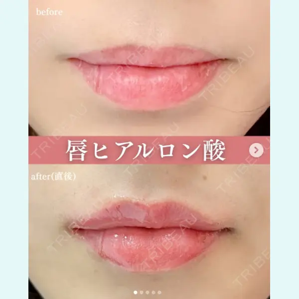 ルラ美容クリニック 上野院 沖津 勇気医師の症例