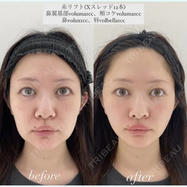 X CLINIC 恵比寿院 辻村 梢医師の症例
