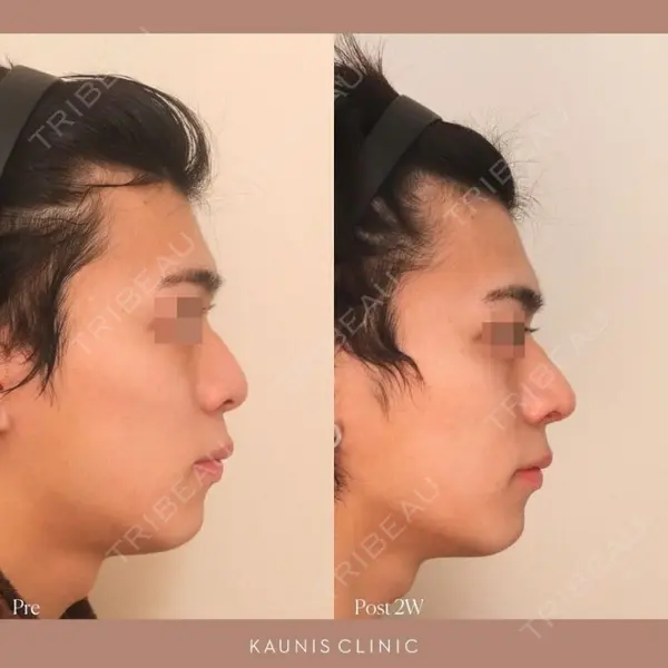 KAUNIS CLINIC（カウニスクリニック）の症例