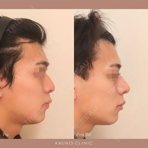 KAUNIS CLINIC（カウニスクリニック）の症例