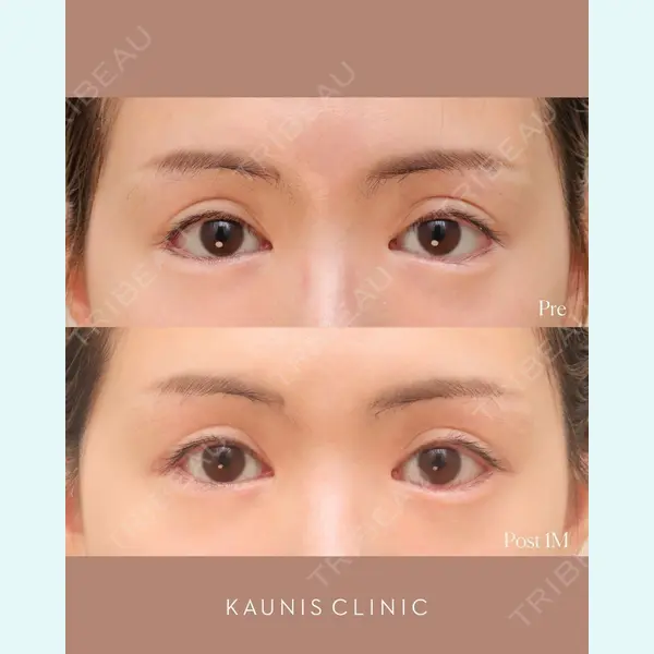 KAUNIS CLINIC（カウニスクリニック）の症例